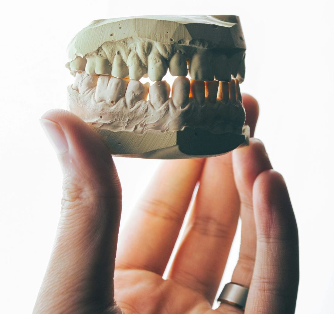 Dentist holding a plaster dental cast
